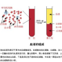 血浆粘度1.80高吗,当我们谈论血液的粘度时，我们实际上在讨论血浆的粘度