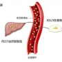 胆固醇偏高1.85,总胆固醇（CHOL）2.58 甘油三脂1.85，问题大不大？