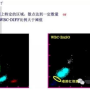 白细胞1.85，警报拉响：你的健康面临严重威胁！